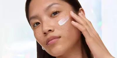 Woman with dark spots on face
