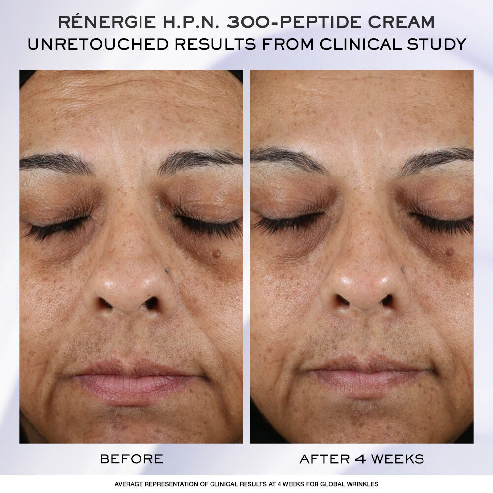 Renergie H.C.F. Triple Serum Discovery Set