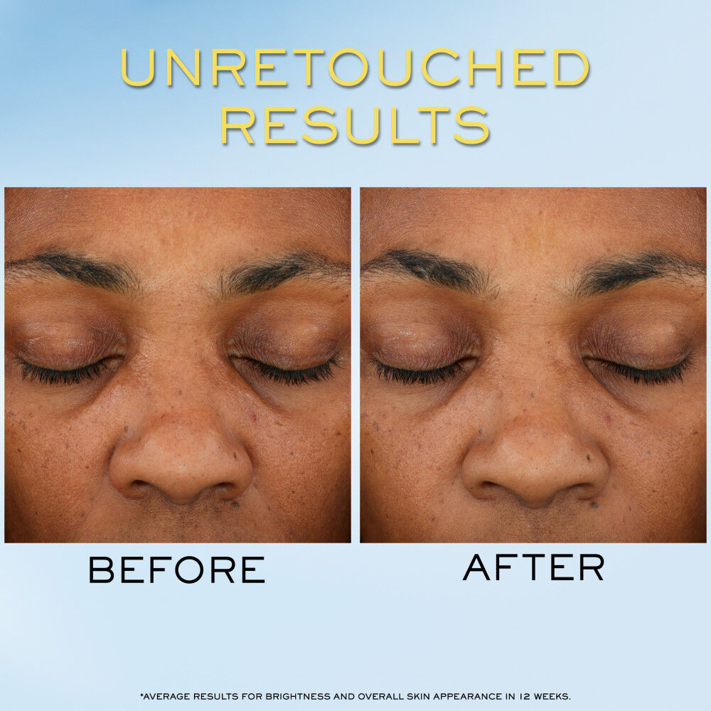 Unretouched before and after of a medium-deep skin woman’s face to show Supra Screen SPF 50+ results 