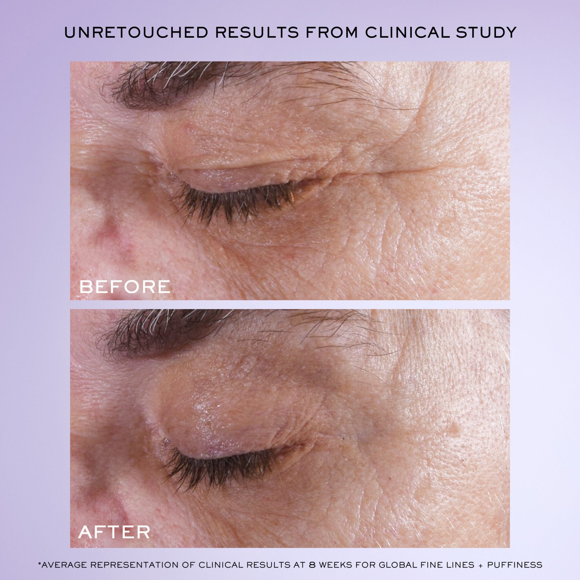 Renergie H.C.F. Triple Serum Eye