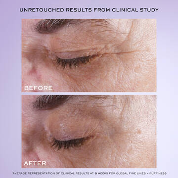 Renergie H.C.F. Triple Serum Eye