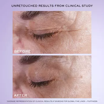 Renergie H.C.F. Triple Serum Eye