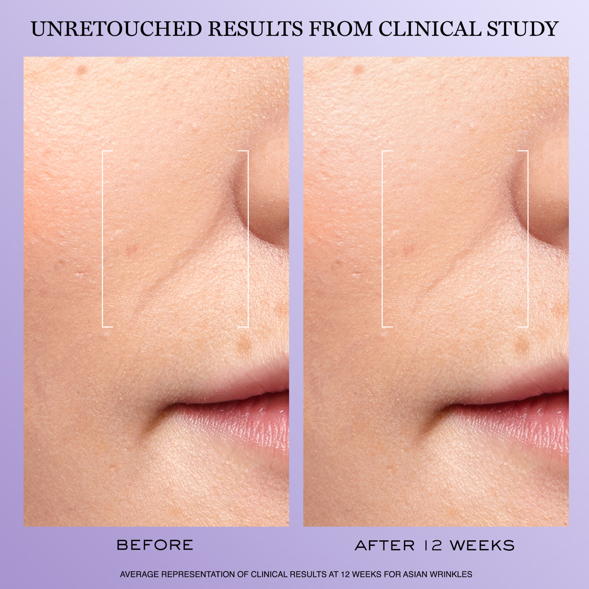 Renergie H.C.F. Triple Serum