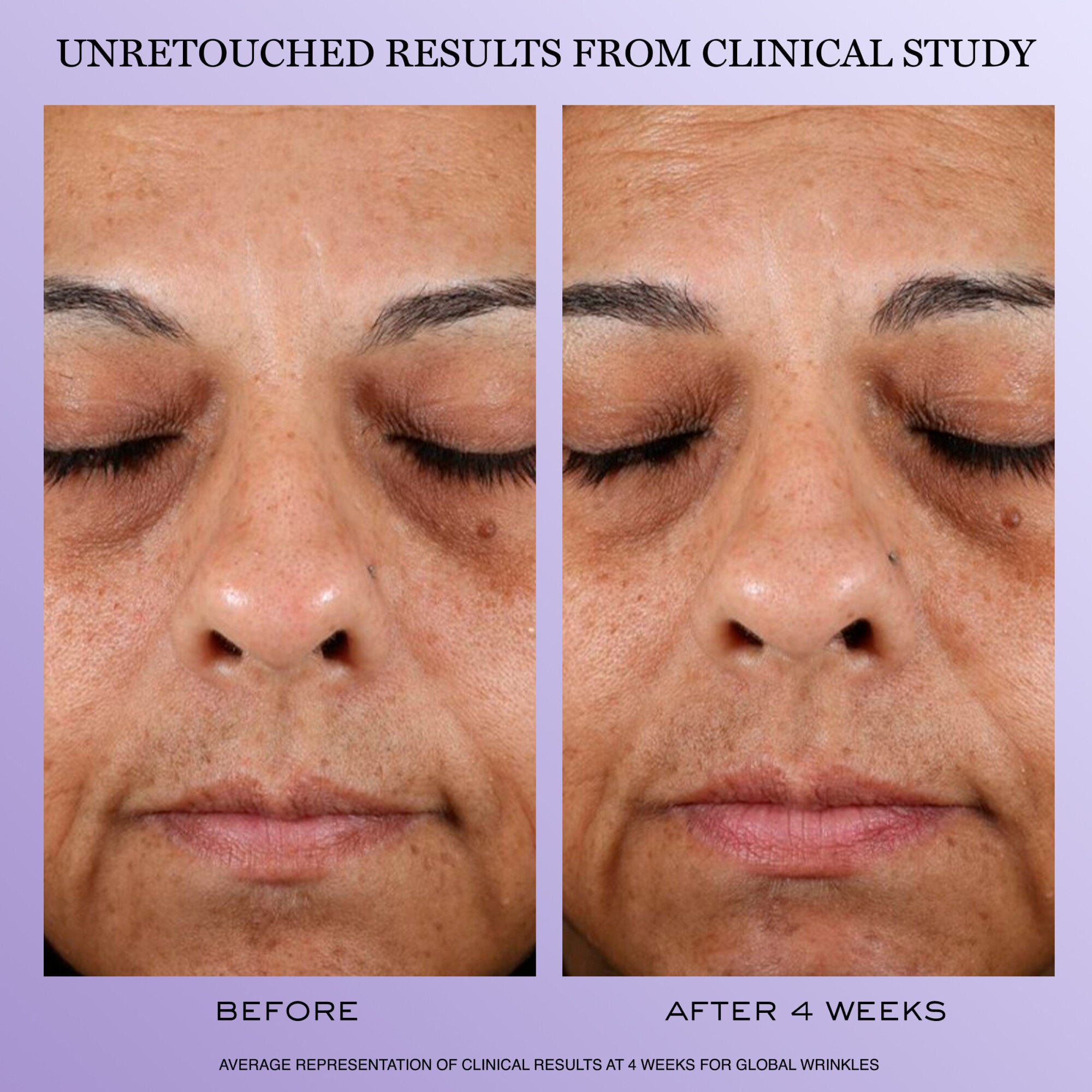 Renergie H.P.N. 300-Peptide Cream