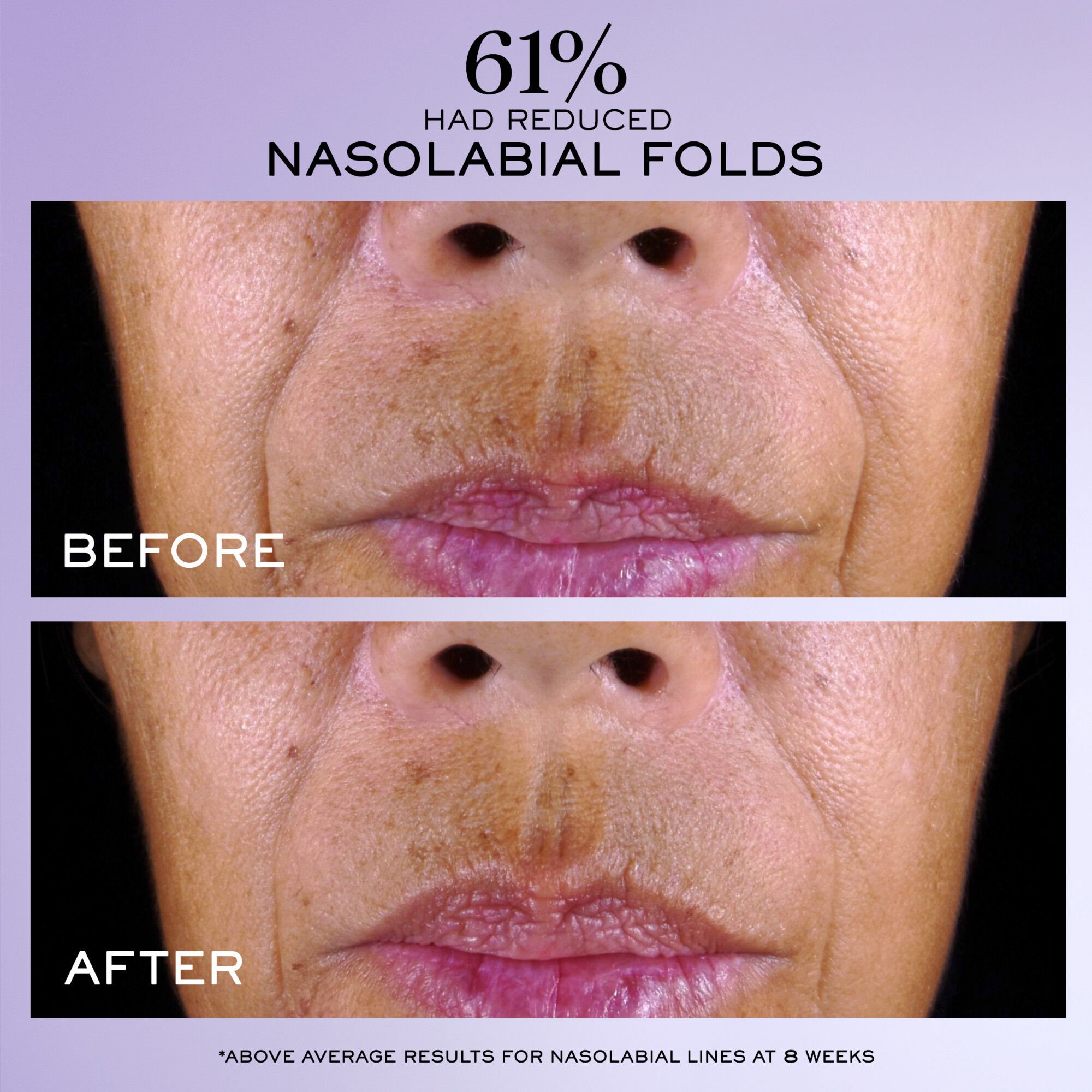 Renergie C.R.x. Triple Serum Retinol