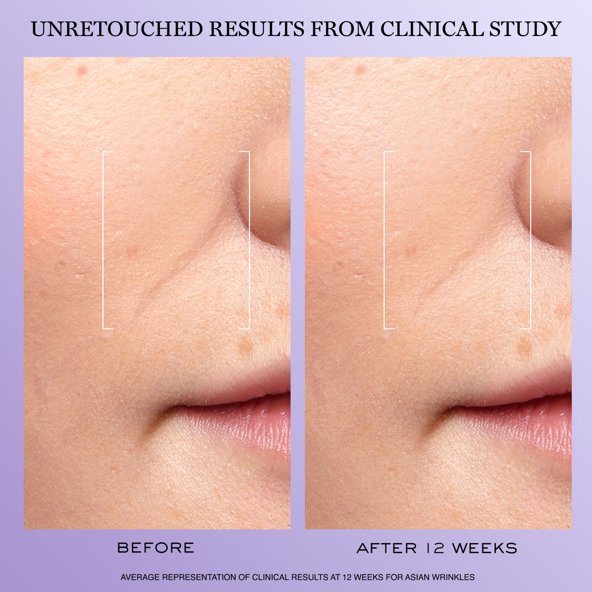 Renergie H.C.F. Triple Serum