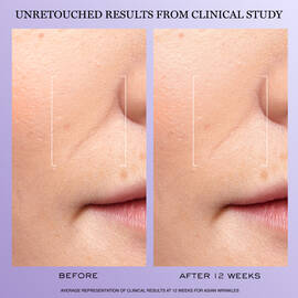 Renergie H.C.F. Triple Serum