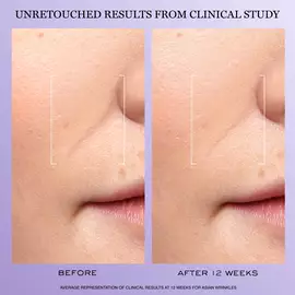 Renergie H.C.F. Triple Serum