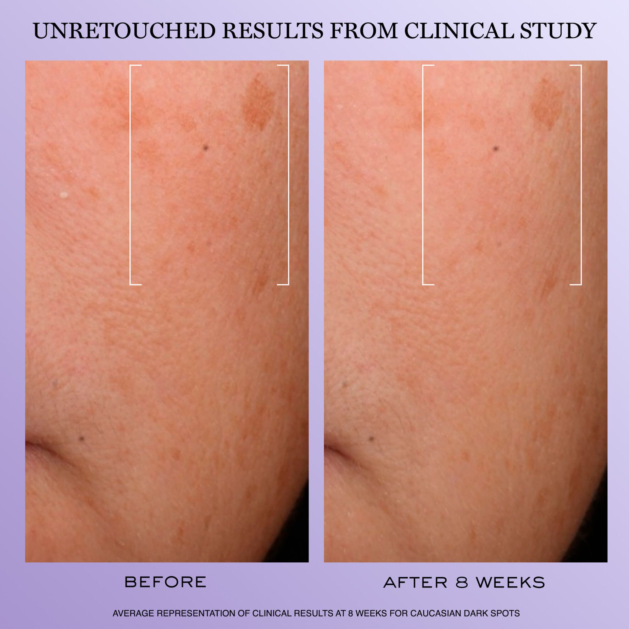 Renergie H.C.F. Triple Serum