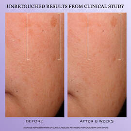 Renergie H.C.F. Triple Serum