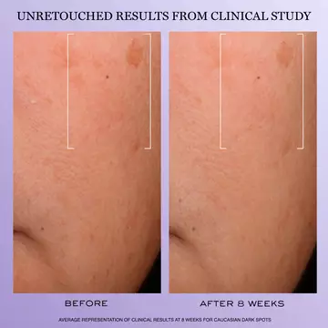 Renergie H.C.F. Triple Serum