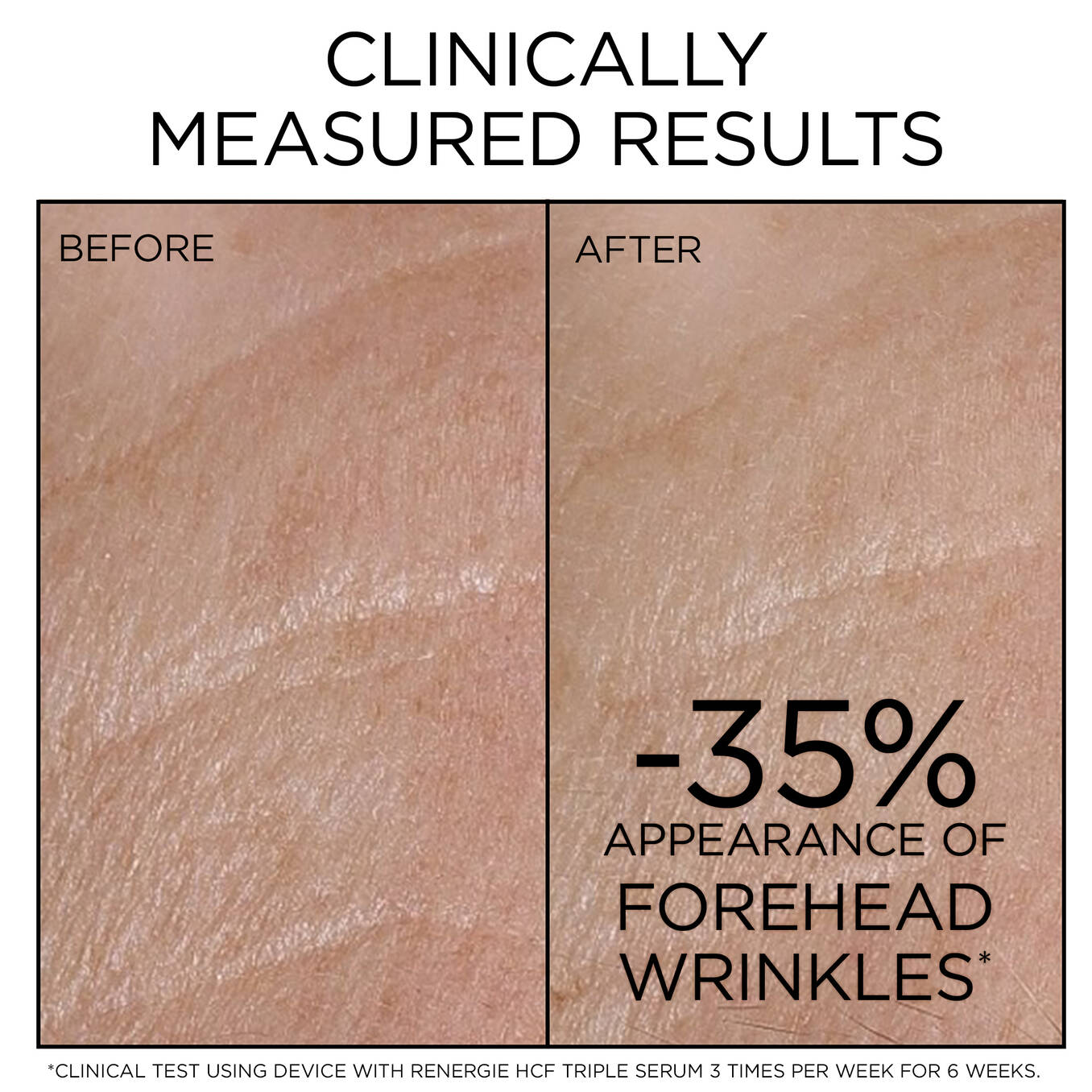 Booster Cut Rénergie Nano-Resurfacer 400 Booster Skincare Device - Lancôme