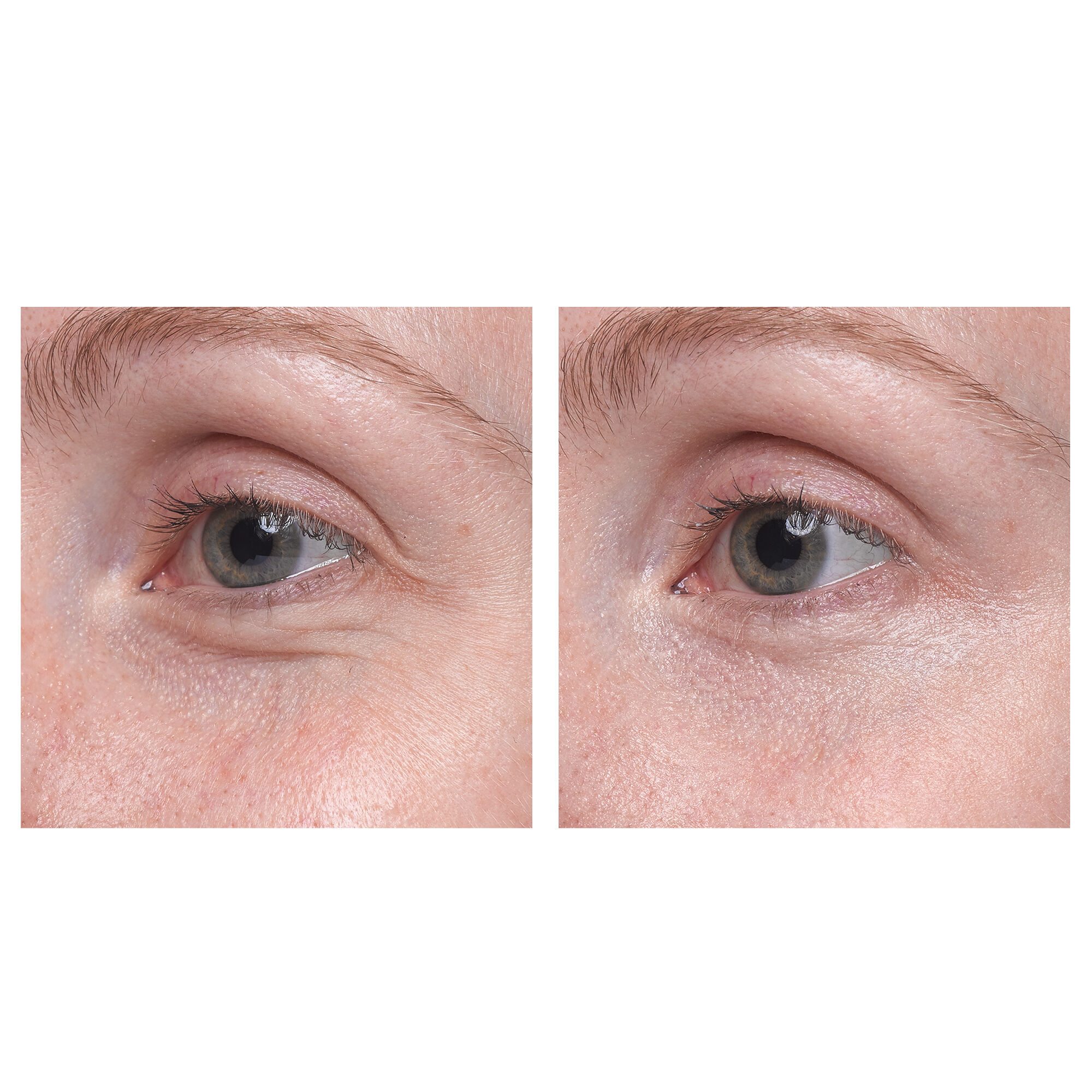 lancôme visionnaire yeux eye cream
