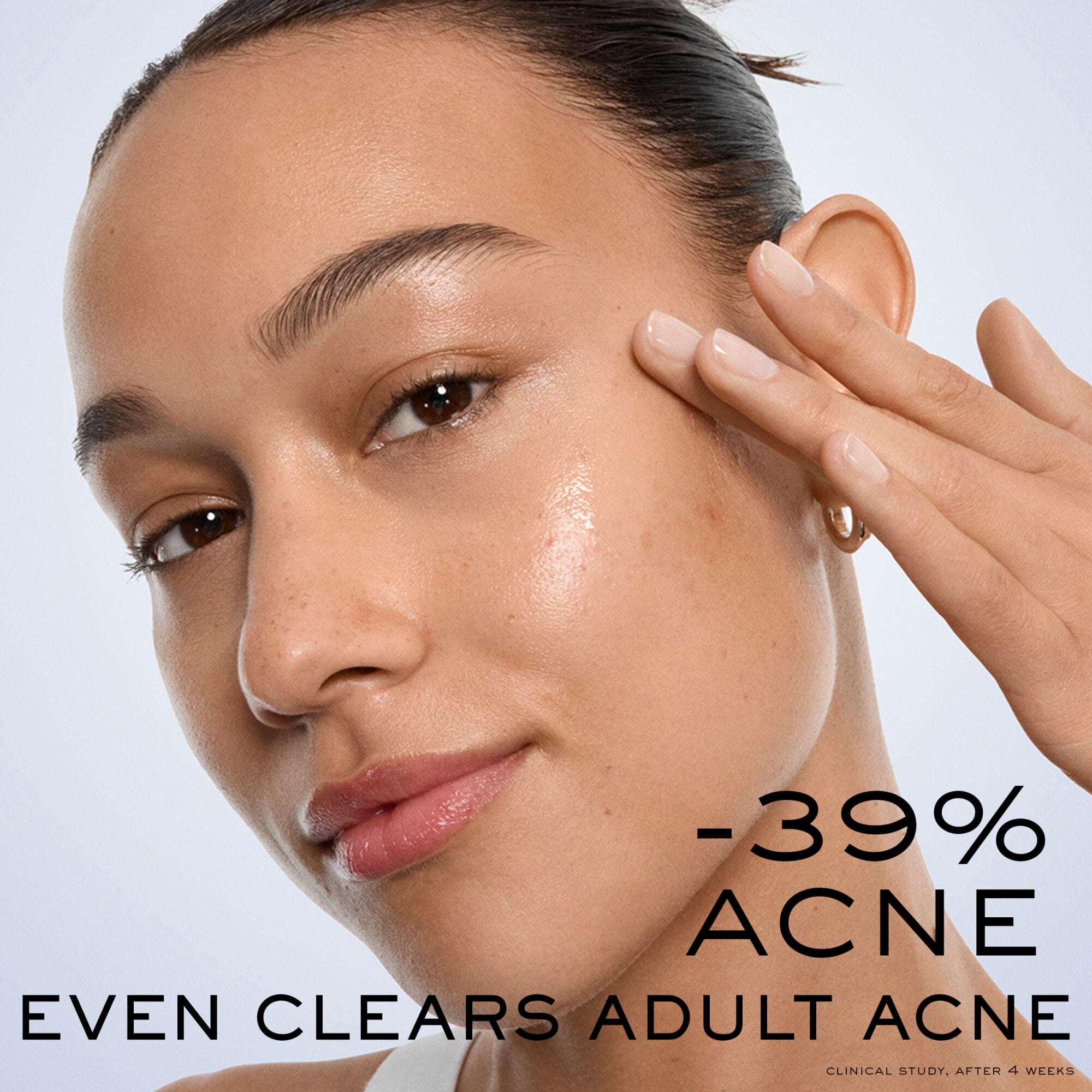 Clarifique Bx-Interceptor™ Acne Treatment