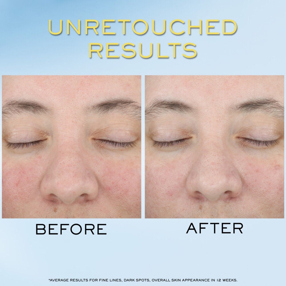 Unretouched before and after of a fair skin woman’s face to show Supra Screen SPF 50+ results 