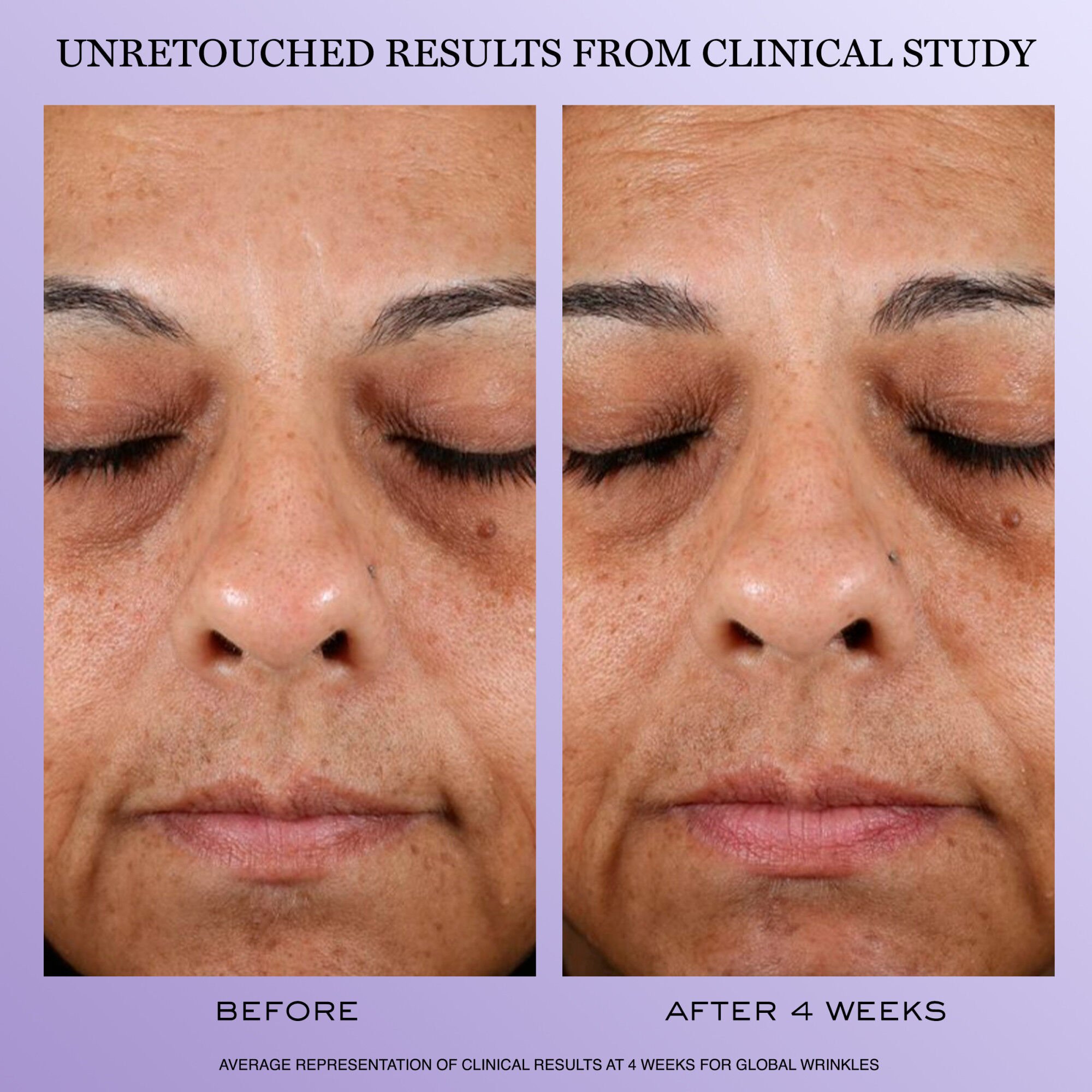 Lancome’s Ultimate Skin Recovery Routine