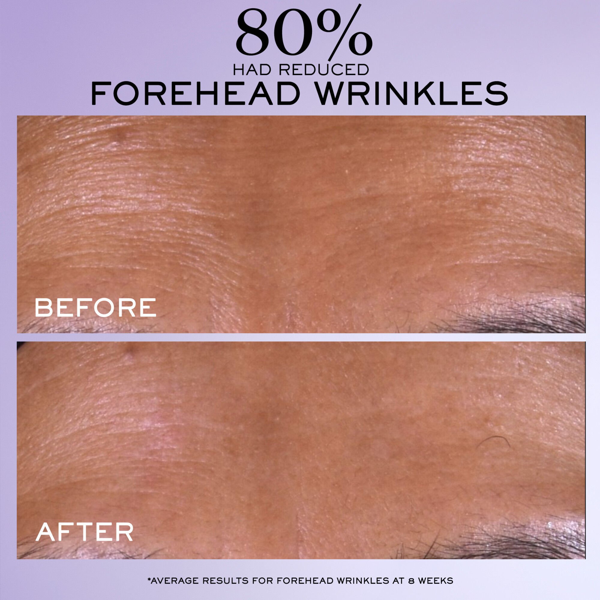 Renergie C.R.x. Triple Serum Retinol