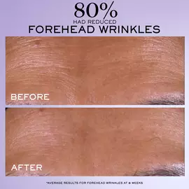 Renergie C.R.x. Triple Serum Retinol