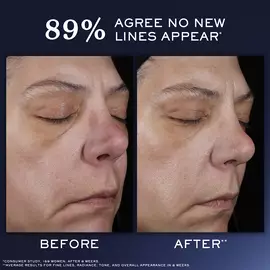 Genifique Ultimate Recovery Serum