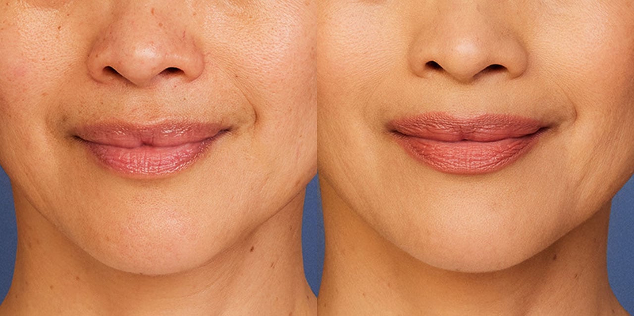 Bare lips and soft glam lips side by side for comparison
